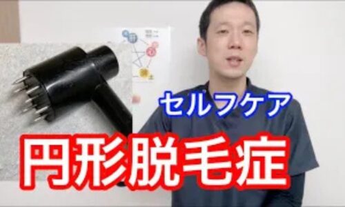 円形脱毛症の原因となる肺の機能低下やアレルギーとの繋がりを解説し、自宅でできる梅花鍼（ばいかしん）を使った頭皮ケアの強さや頻度を説明する石丸院長