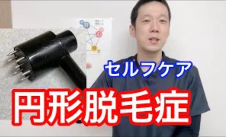 円形脱毛症の原因となる肺の機能低下やアレルギーとの繋がりを解説し、自宅でできる梅花鍼（ばいかしん）を使った頭皮ケアの強さや頻度を説明する石丸院長