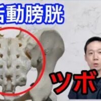 尿が十分に溜まっていなくても膀胱が勝手に収縮してしまう過活動膀胱を改善するために、加齢による腎タイプに効く仙骨のツボ（膀胱兪・中髎）や、ストレスによる肺タイプに効く腕のツボ（尺沢）の位置と温め方を解説する石丸院長