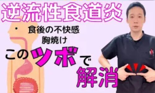 胃液や消化物が逆流して胸焼けやみぞおちの痛みを引き起こす逆流性食道炎を改善するために、お腹のおへそから親指4本分上にあるツボ「中脘(ちゅうかん)」の位置とお灸(せんねん灸)を用いた1日3回の温活ケアを解説する石丸院長