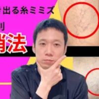皮膚の浅い部分に現れる赤い糸ミミズのような毛細血管「細絡(さいらく)」と体内の血行不良「瘀血(おけつ)」を解消するために、運動習慣や湯船入浴、香味野菜や青魚を取り入れた生活改善法を解説する石丸院長