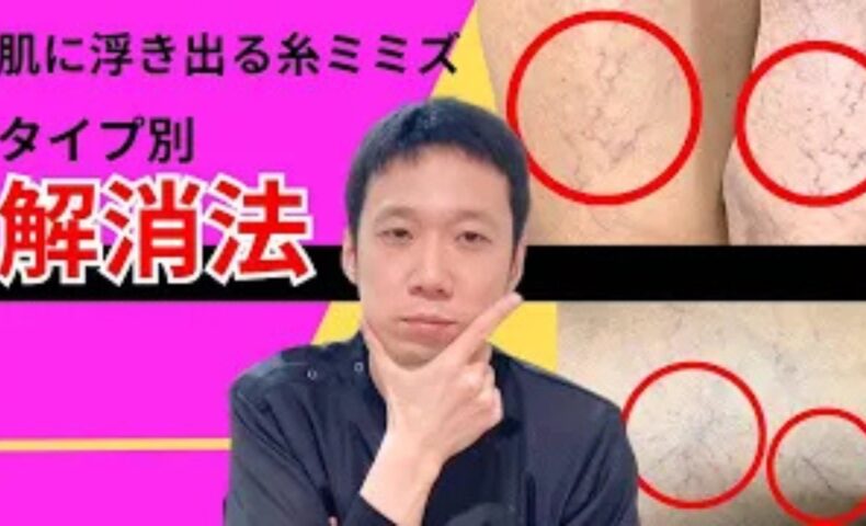 皮膚の浅い部分に現れる赤い糸ミミズのような毛細血管「細絡（さいらく）」と体内の血行不良「瘀血（おけつ）」を解消するために、運動習慣や湯船入浴、香味野菜や青魚を取り入れた生活改善法を解説する石丸院長