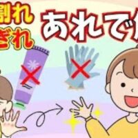 冬場の乾燥や水仕事で生じる指先のつらいひび割れやあかぎれの痛みを改善するために、市販の台座灸を患部に直接据えて血流を促し痛みを和らげる手順を解説する石丸院長