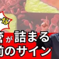 脳梗塞や心筋梗塞を未然に防ぐために、足の皮膚などに現れる紫色のクモの巣状血管「細絡(さいらく)」と体内のドロドロ血「瘀血(おけつ)」の危険サイン、湯船温活や食事改善による予防法を解説する石丸院長