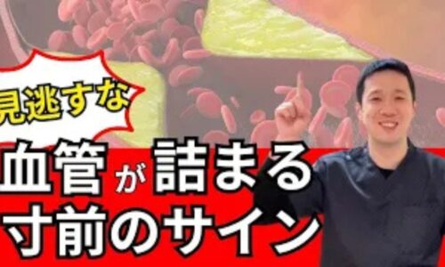 脳梗塞や心筋梗塞を未然に防ぐために、足の皮膚などに現れる紫色のクモの巣状血管「細絡（さいらく）」と体内のドロドロ血「瘀血（おけつ）」の危険サイン、湯船温活や食事改善による予防法を解説する石丸院長