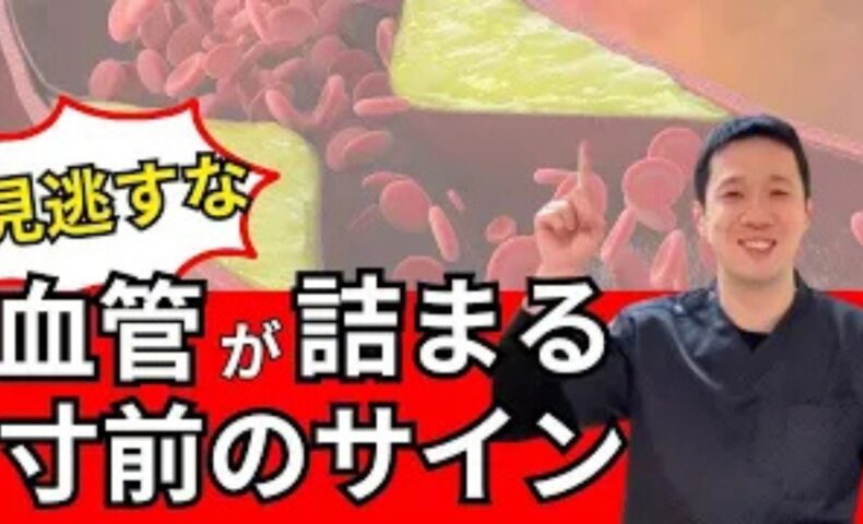 脳梗塞や心筋梗塞を未然に防ぐために、足の皮膚などに現れる紫色のクモの巣状血管「細絡（さいらく）」と体内のドロドロ血「瘀血（おけつ）」の危険サイン、湯船温活や食事改善による予防法を解説する石丸院長