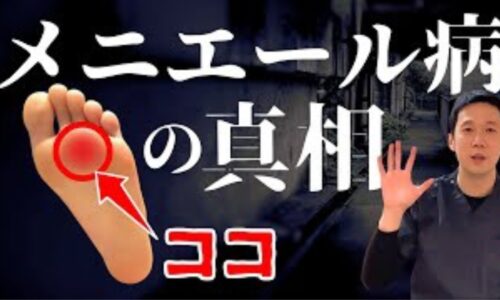 天井がぐるぐる回る回転性めまいや耳鳴り、難聴を伴うメニエール病を改善するために、足の指を曲げた時に最もへこむ場所にある腎の特効ツボ「湧泉（ゆうせん）」の位置と親指による30秒指圧法を解説する石丸院長